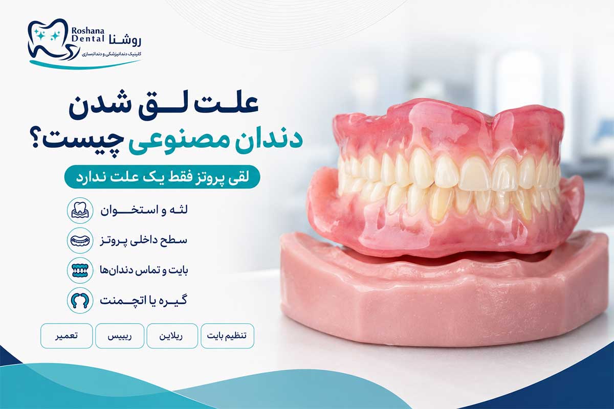 علت لق شدن دندان مصنوعی چیست و چگونه برطرف میشود؟ 1 بررسی علت لق شدن دندان مصنوعی و روشهای اصلاح آن