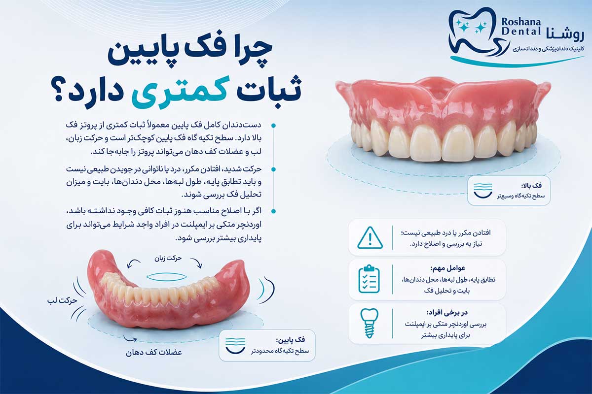 علت لق شدن دندان مصنوعی چیست و چگونه برطرف میشود؟ 5 دلایل ناپایداری و لق شدن دندان مصنوعی فک پایین