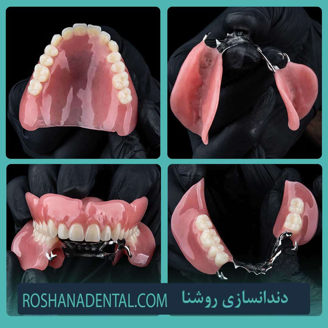 پروتز کامل دندان 20 نمونه با طراحی زیباییشناختی نتیجه ساخت دندان مصنوعی کامل در خارج از دهان بیمار