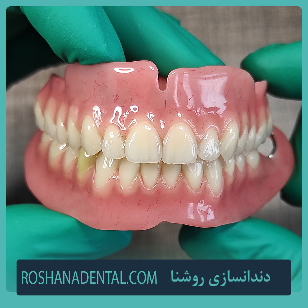 پروتز کامل دندان 32 نمونه طبیعی نتیجه ساخت دندان مصنوعی کامل در خارج از دهان بیمار