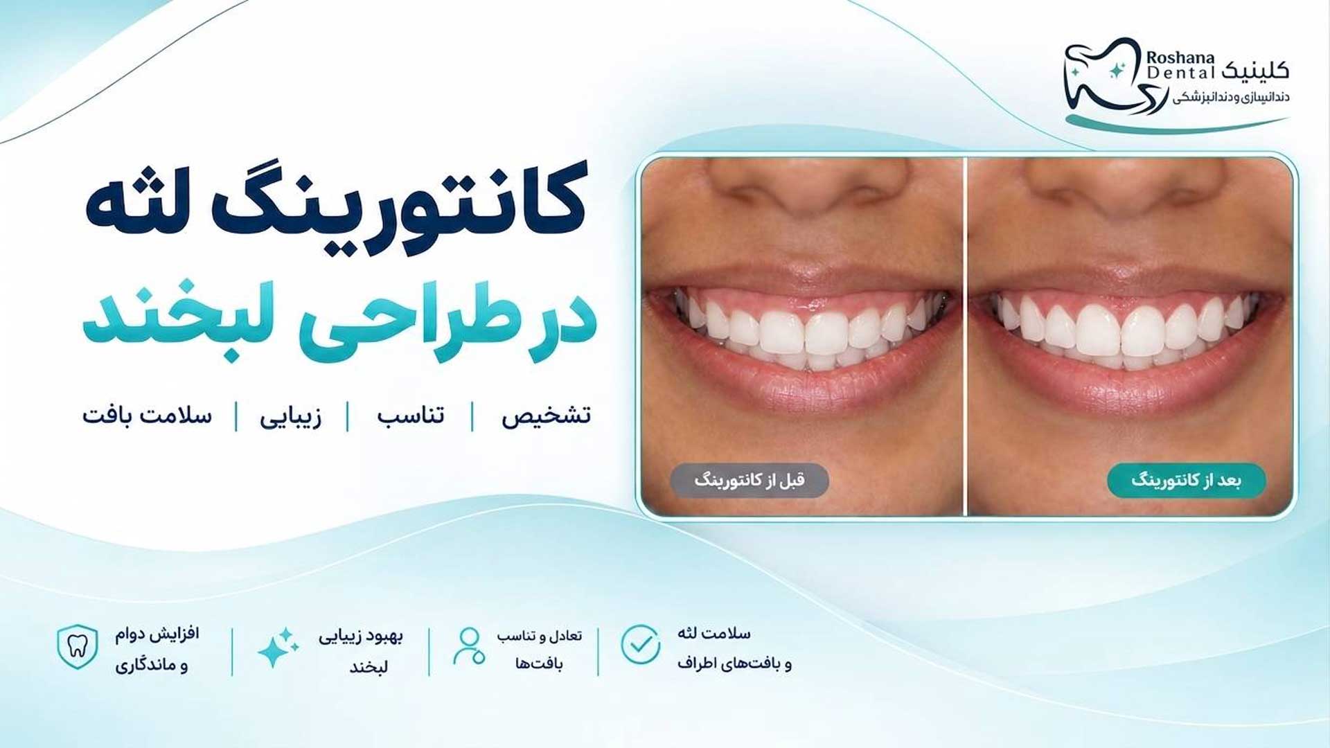 تصویر شاخص قبل و بعد کانتورینگ لثه