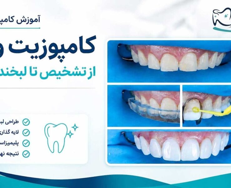 تصویر شاخص مقاله کامپوزیت ونیر